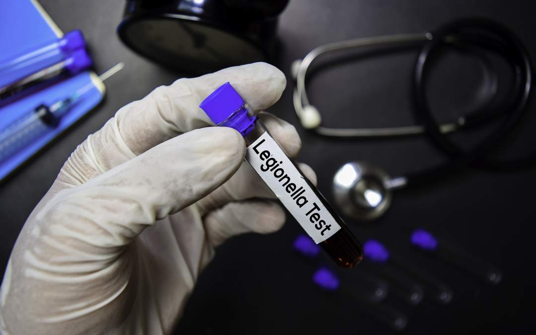 Why Your Property May Sometimes Need A Legionella Test